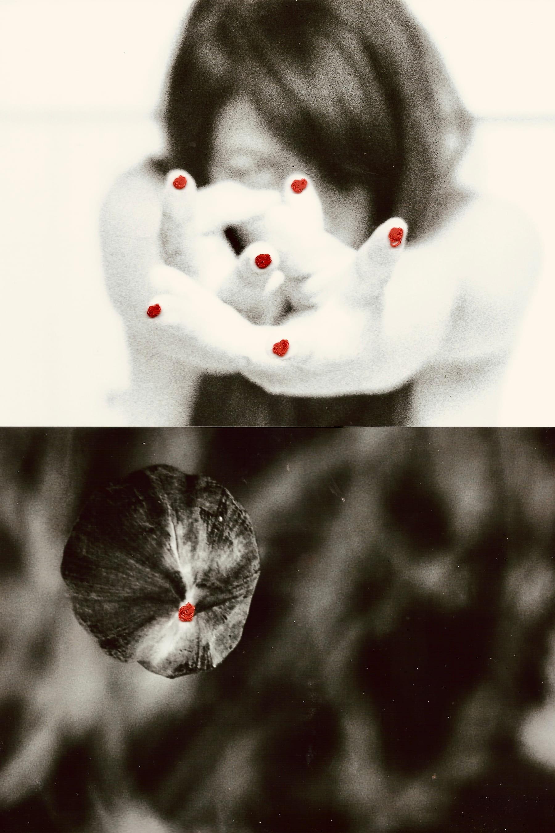 Sutures 2 © PGC