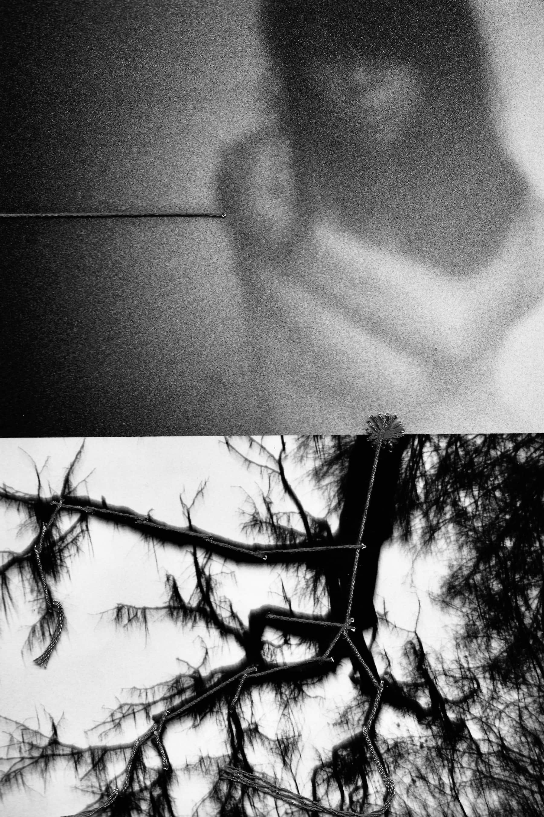 Sutures 4 © PGC