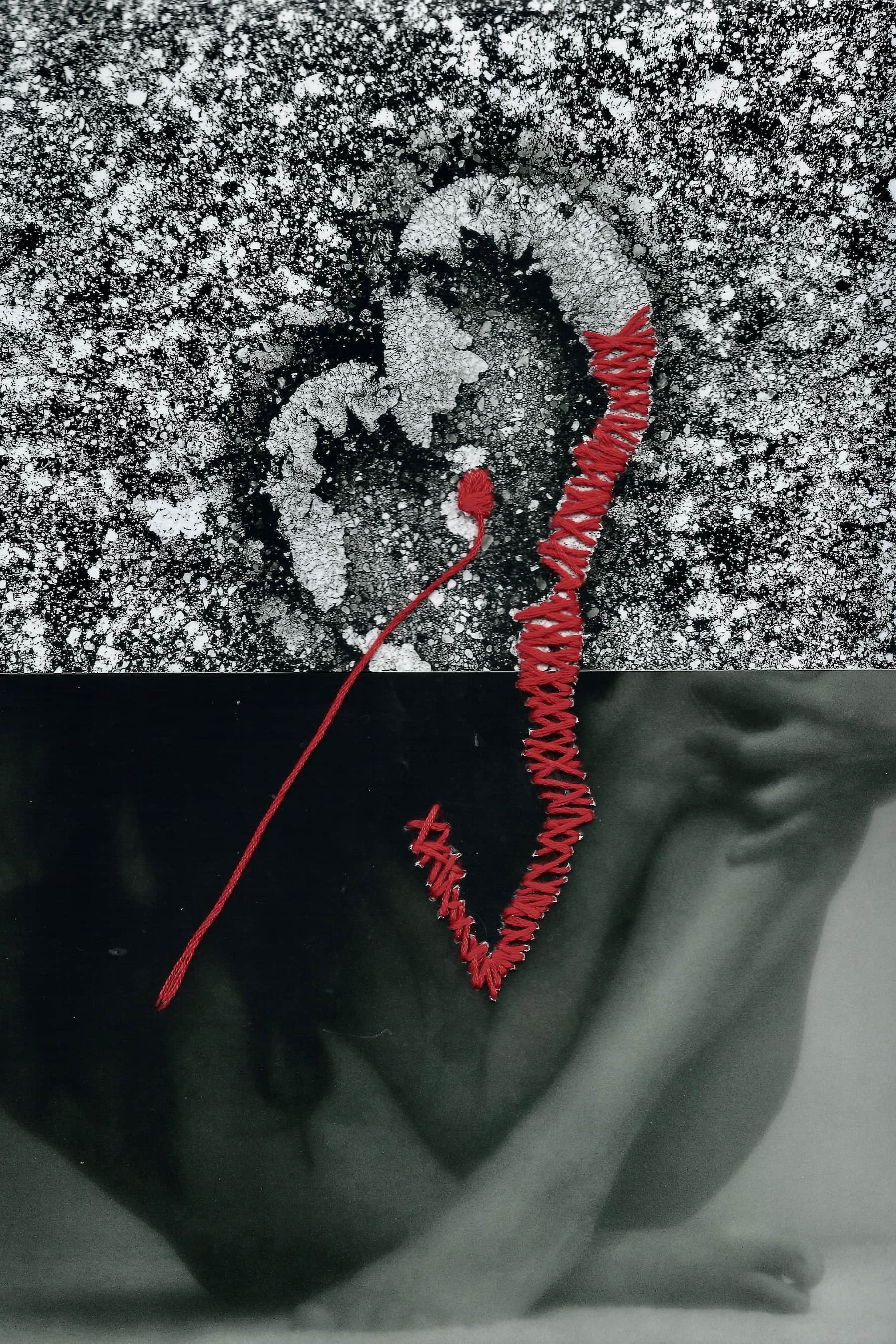 Sutures 7 © PGC